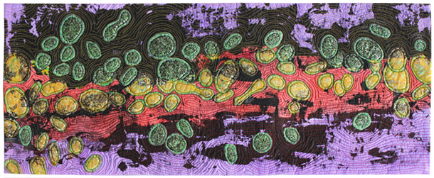 Microbial Sunset